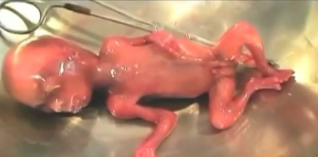 And Some People Think Evil Doesn’t Exist – More On Planned&nbsp;Parenthood